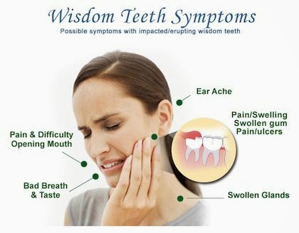 wisdom teeth removal 