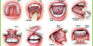 At Aurora Yonge Dental we understanding the  importance of regular oral cancer screenings.